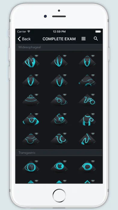 ECHO Views - Transesophageal Echocardiography