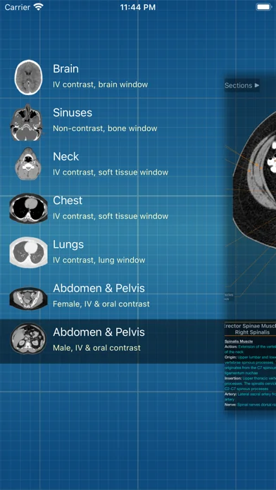 X-Anatomy Pro