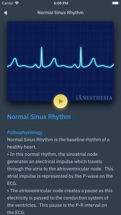 ACLS Rhythms and Quiz screenshot 4