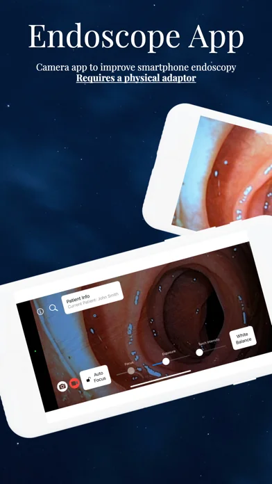 Endoscope App