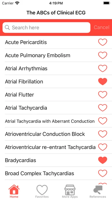 Clinical ECG Interpretation