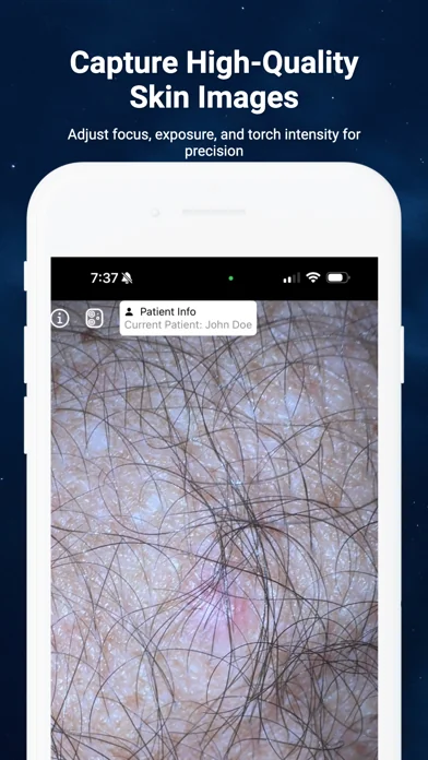 Dermatoscope