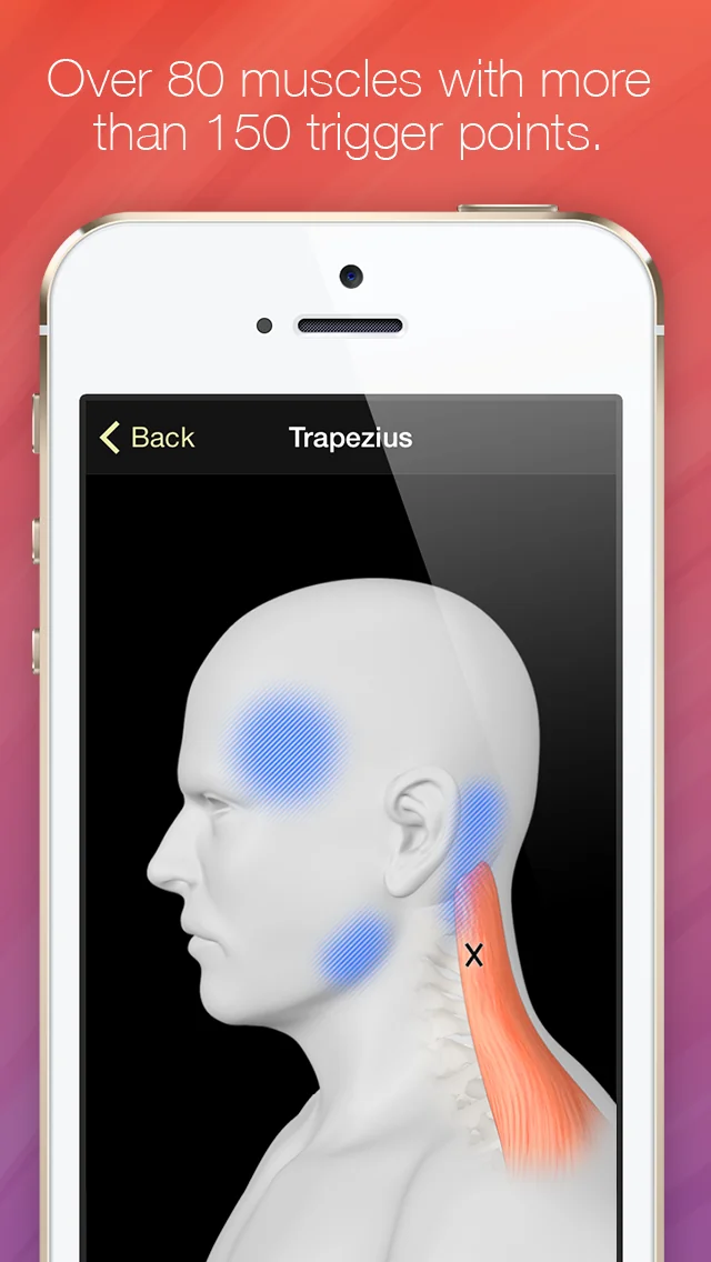 Trigger Points - Guide & Reference
